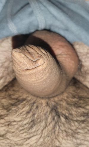 My small uncut penis