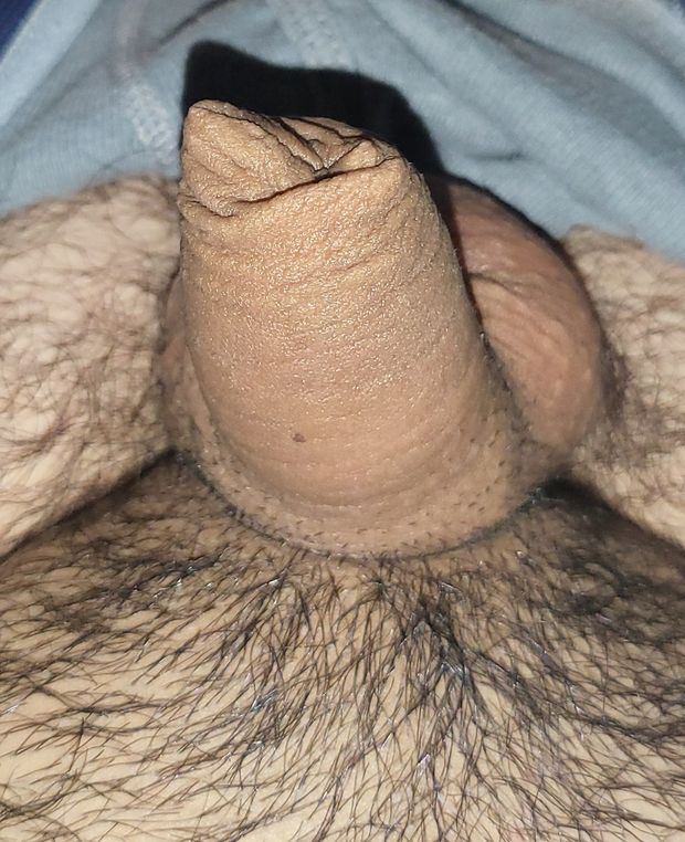 My tiny uncut penis