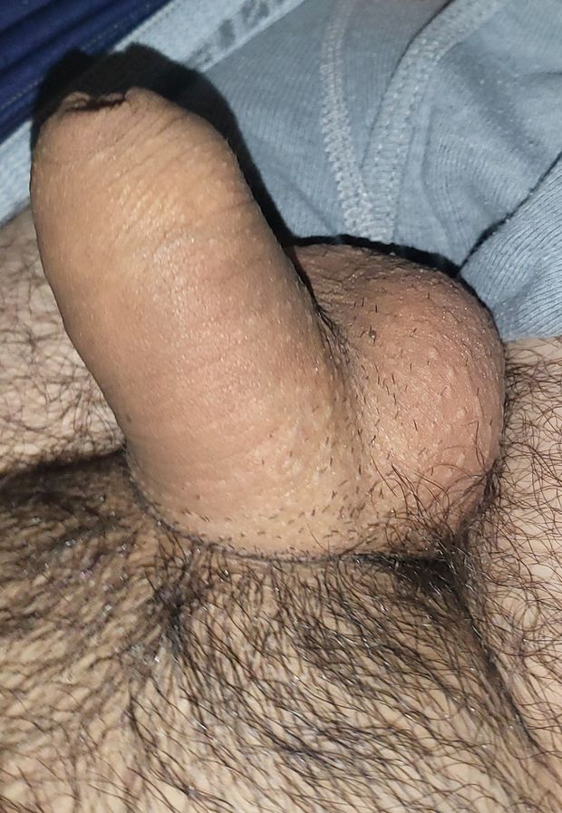 Small uncut penis