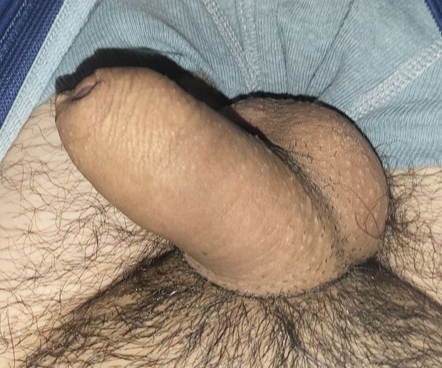 Small uncut penis naked