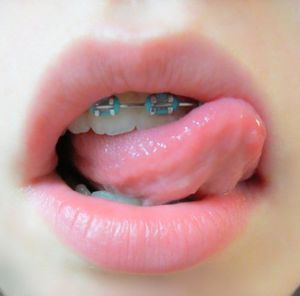 daddy's dau has needs