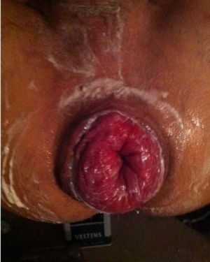 Perfect meathole to lick it really wet and then fuck it and shoot your sperm into it