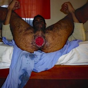 Freshly fisted wide open fuckhole