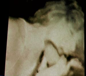 Another hidden cam blowjob pic