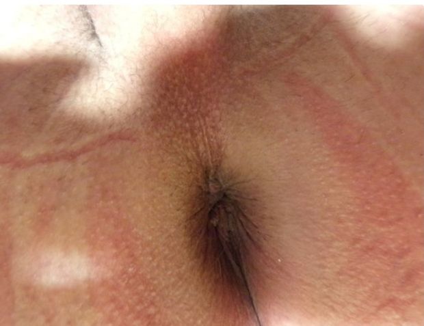 Brown eye