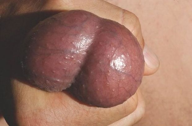 Balls
