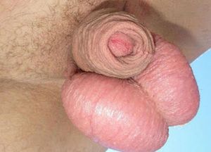 Foreskin + balls