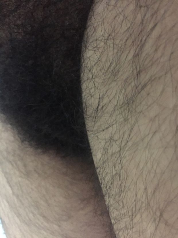 Lots of hair