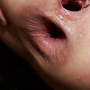 Both holes gaped out