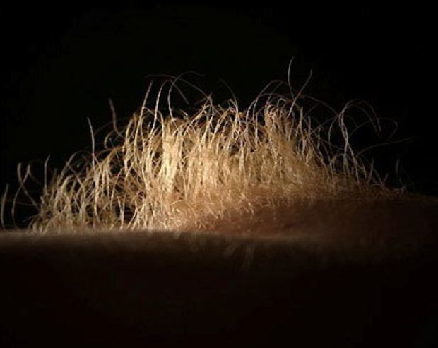 Static bush