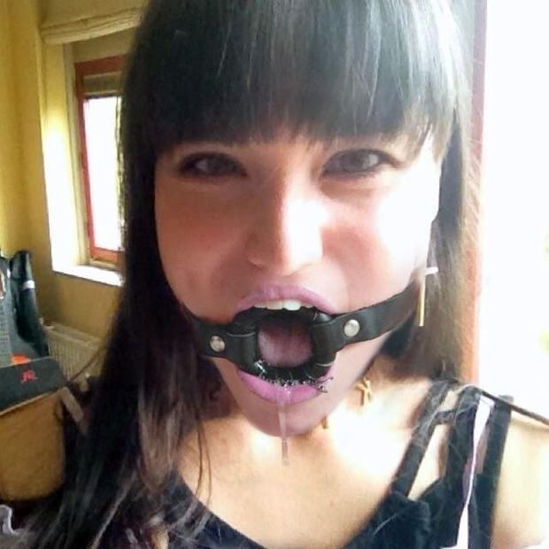 mouthgag