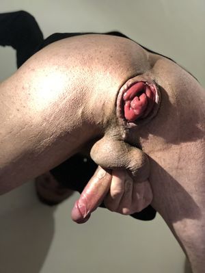 wow magic this anal prolapse ... it becomes more and more demonstrative