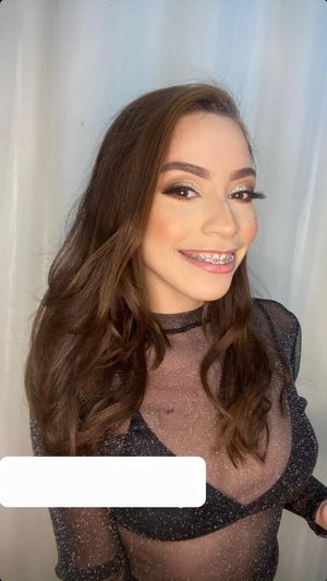 Cute Princess with Smile Braces