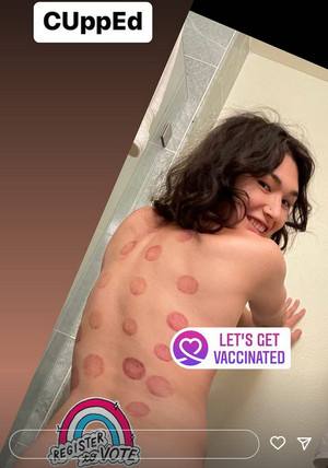 Sarah Schwartz aka Sarah SeaSol shows off her weird cupping fetish
