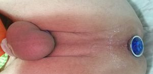 My pretty butt hole jewel