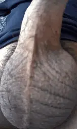 Close up of my erect shaft! You like moles on a dick or nah?