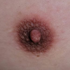 My nipple