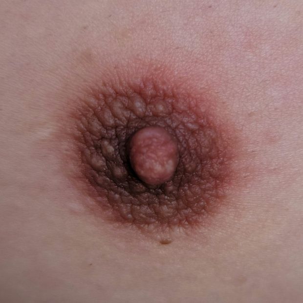 My nipple
