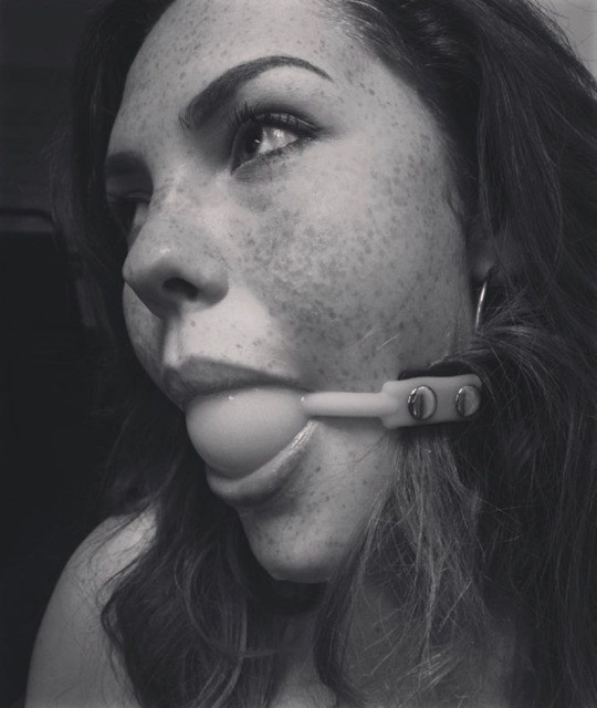 Oooh: freckles!