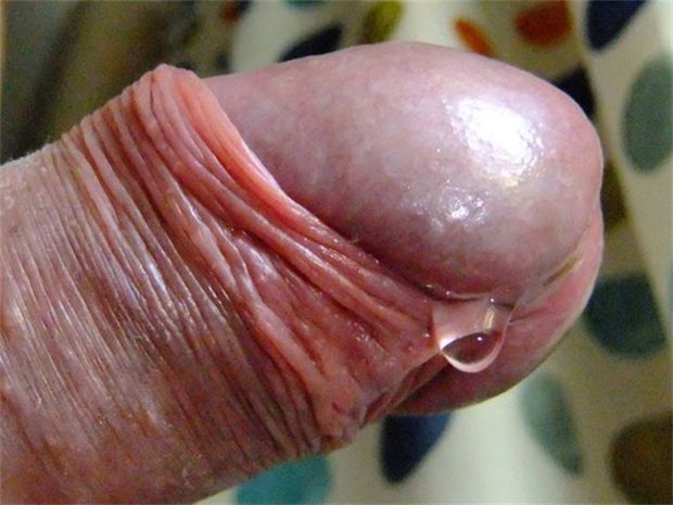 Awesome foreskin and purple head!