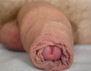 Foreskin