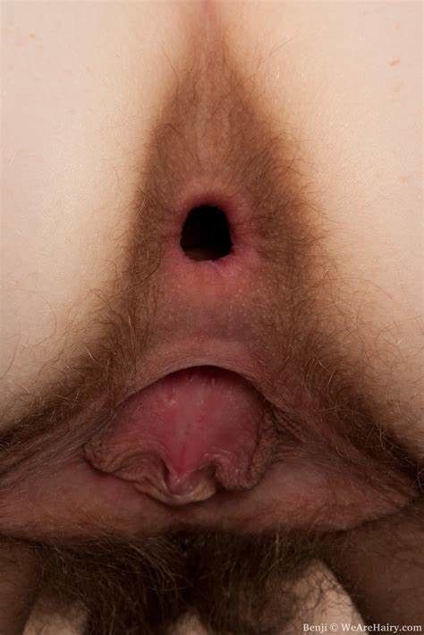 Whistle hole