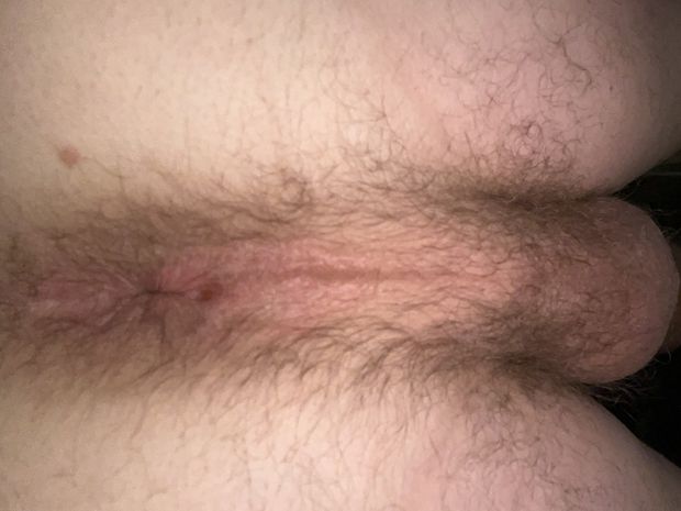 My hairy hole