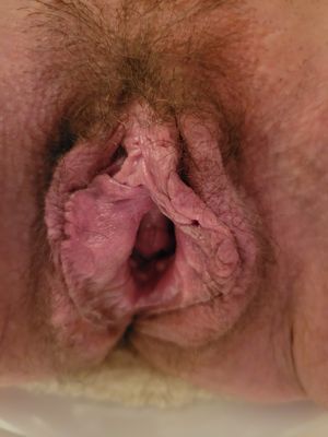 swollen pussy