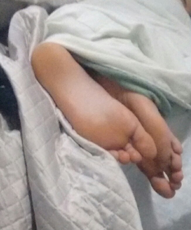 toes