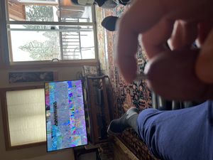 Sounding with glans and balls ligation