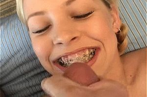Cumming on her braces