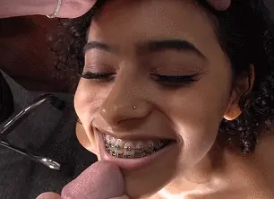 Cumming on her braces