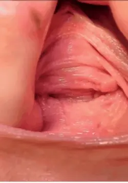 Close up