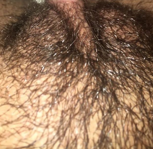 Bush