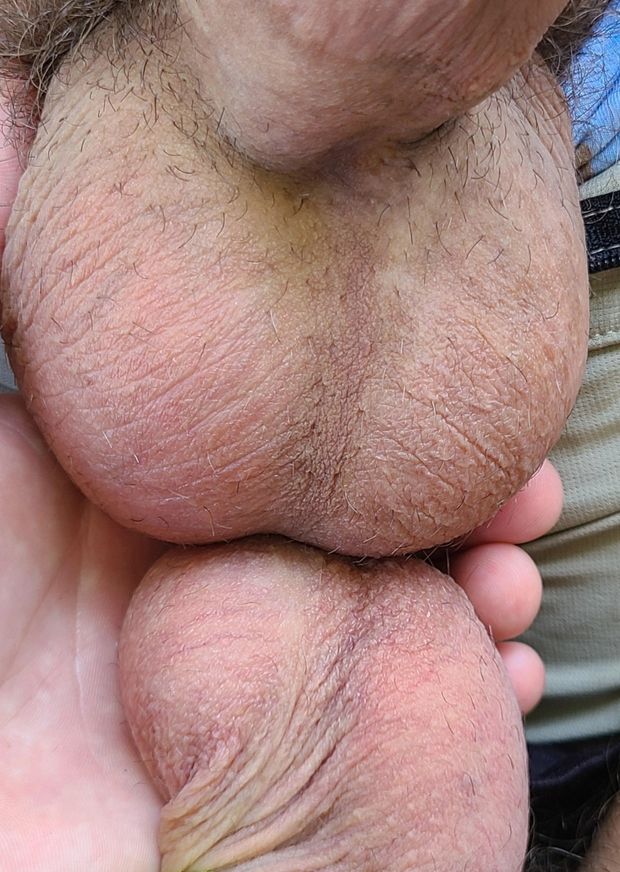 Balls on balls