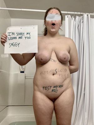 Shamed into Getting Her Tits Fixed