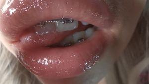 braces glossy lips