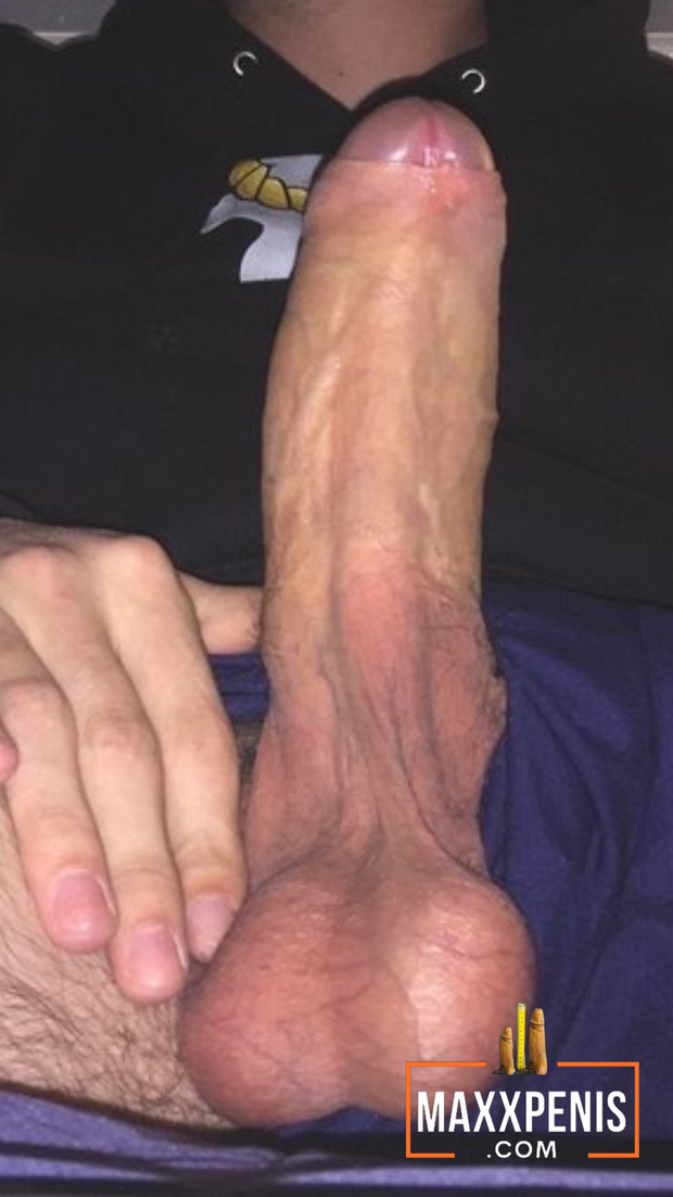 My foreskin here