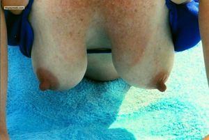 All this and freckles too.