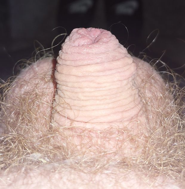 Tiny shrivelled wrinkled mole Hill