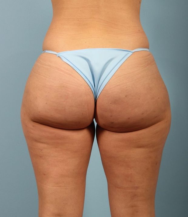 PHATTY