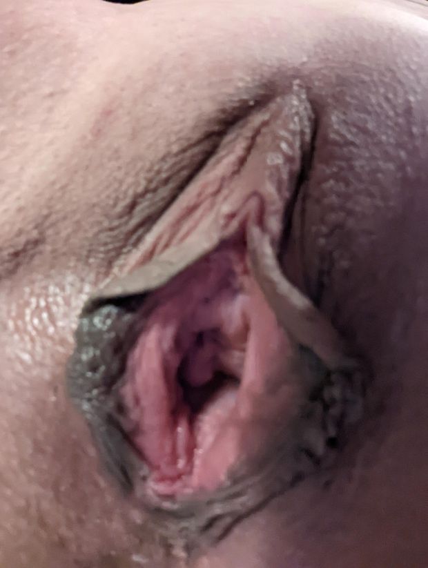 Pursed pussy hole