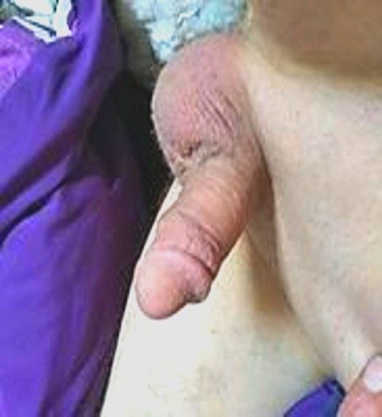 full hardon and under 3 inches