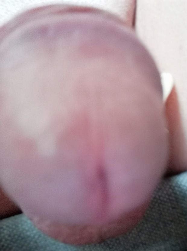 Me dick
