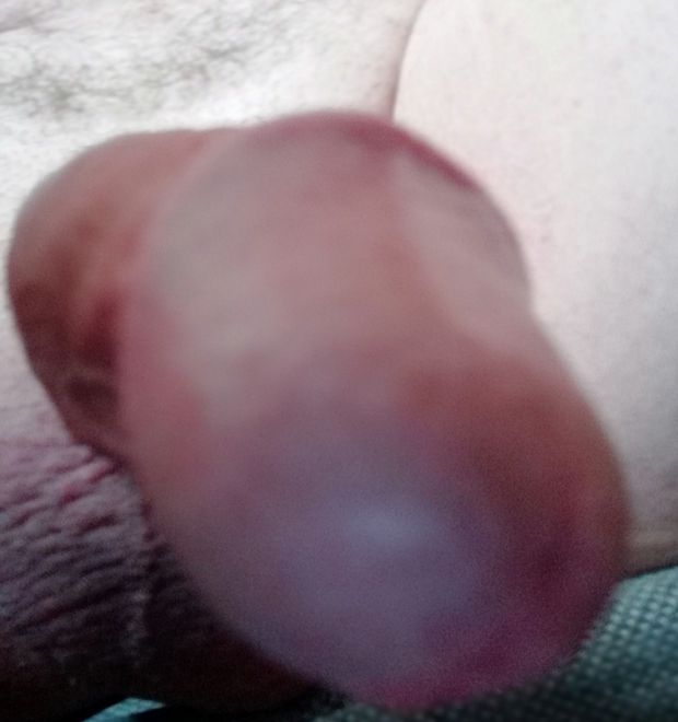 Me dick