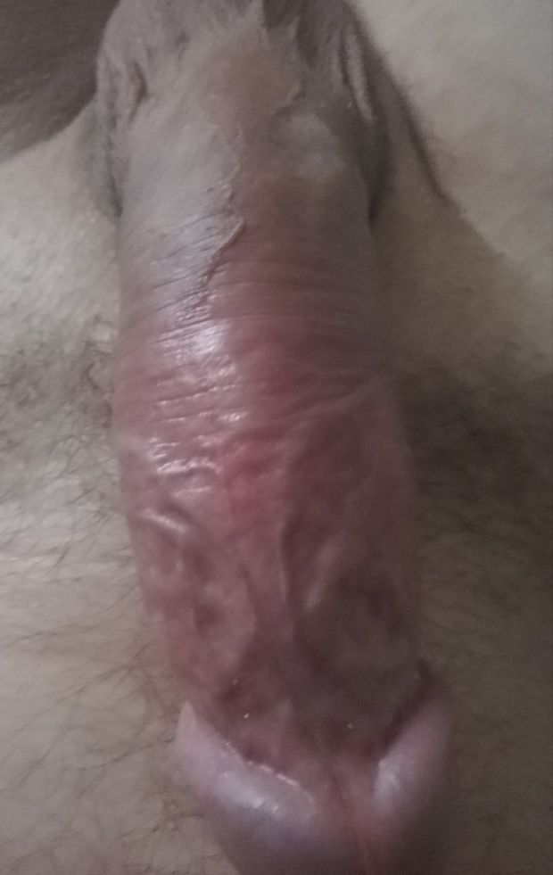 Me dick