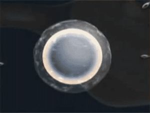 Sperm attacking an egg