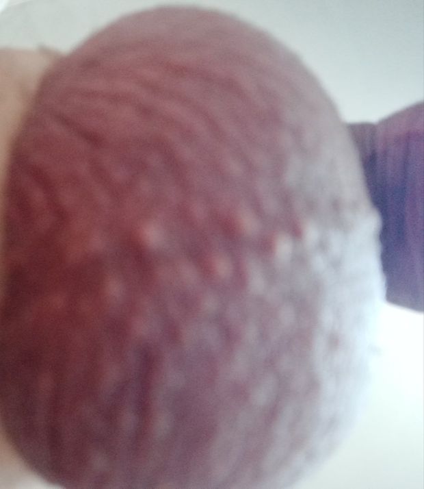 Me balls