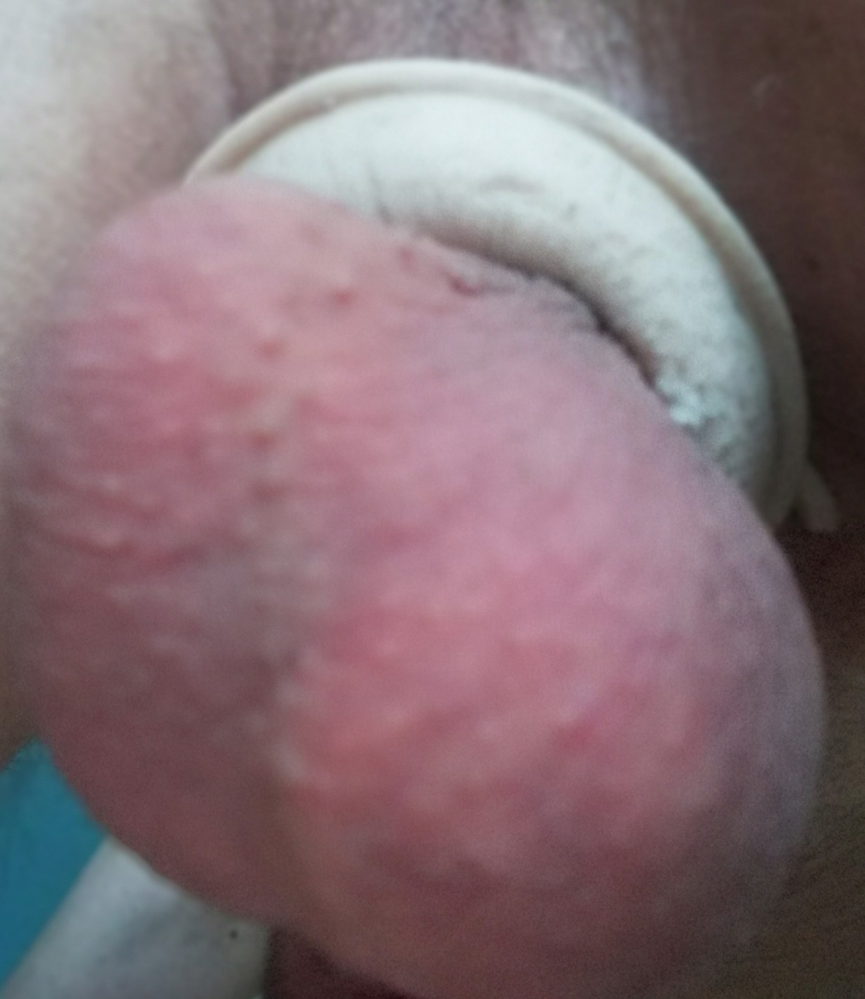 Me balls