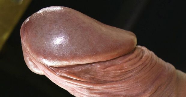 close up